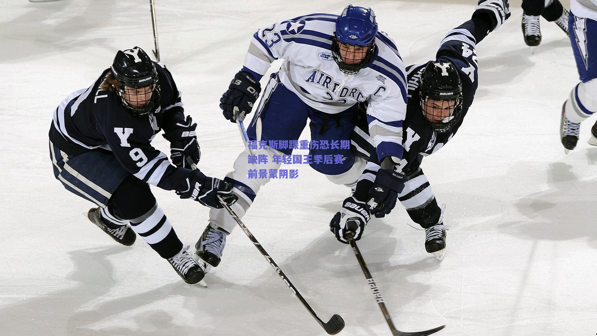 福克斯脚踝重伤恐长期缺阵 年轻国王季后赛前景蒙阴影